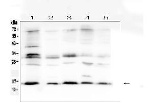 Western blot analysis of ISG15/Ucrp using anti-ISG15/Ucrp antibody . (ISG15 antibody  (AA 2-155))