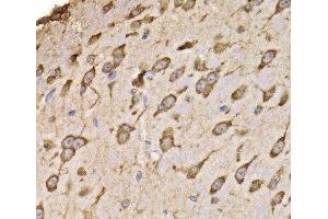 Immunohistochemistry of paraffin-embedded Mouse brain using RPS14 Polyclonal Antibody at dilution of 1:100 (40x lens). (RPS14 antibody)