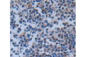 IHC-P analysis of Rat Tissue, with DAB staining. (CMA1 antibody  (AA 22-247))