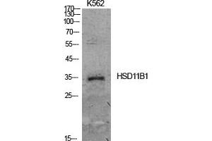 Western Blot analysis of K562 cells using 11β-HSD1 Polyclonal Antibody. (HSD11B1 antibody  (N-Term))