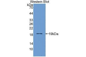 Western blot analysis of the recombinant protein. (IL3RA antibody  (AA 19-157))