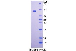 SDS-PAGE analysis of Human PAX9 Protein. (PAX9 Protein)