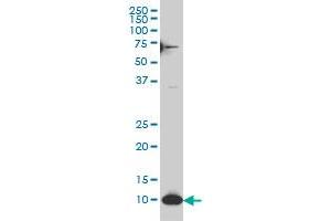 SNAPC5 monoclonal antibody (M07), clone 6G10 Western Blot analysis of SNAPC5 expression in HL-60 . (SNAPC5 antibody  (AA 1-68))