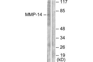 Western Blotting (WB) image for anti-Matrix Metallopeptidase 14 (Membrane-inserted) (MMP14) (C-Term) antibody (ABIN1848675) (MMP14 antibody  (C-Term))