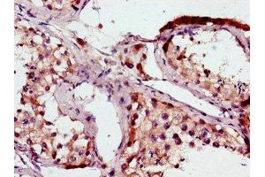 Immunohistochemistry of paraffin-embedded human testis tissue using ABIN7169015 at dilution of 1:100 (BRAF antibody  (AA 12-77))