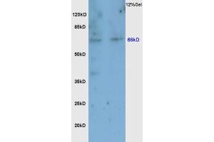 Western Blotting (WB) image for anti-Nuclear Factor (erythroid-Derived 2)-Like 2 (NFE2L2) (AA 430-480) antibody (ABIN737271)