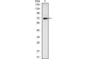 Western blot analysis using NKX2. (NK2 Homeobox 5 antibody)