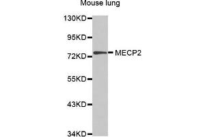 Western Blotting (WB) image for anti-Methyl CpG Binding Protein 2 (MECP2) (AA 1-280) antibody (ABIN6213962) (MECP2 antibody  (AA 1-280))