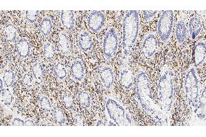 Human tonsil: immunohistochemical staining for CD56. (CD56 antibody  (Extracellular Domain))