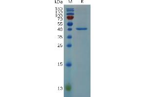 RNASE4 Protein (AA 29-147) (Fc Tag)