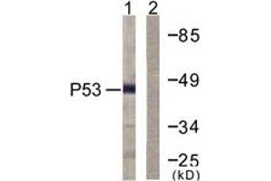 Western blot analysis of extracts from COS7 cells, treated with TSA 400nM 24h, using p53 (Ab-379) Antibody. (p53 antibody  (AA 336-385))