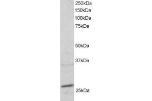 Western Blotting (WB) image for anti-RAB11A, Member RAS Oncogene Family (RAB11A) (C-Term) antibody (ABIN2465288) (RAB11A antibody  (C-Term))