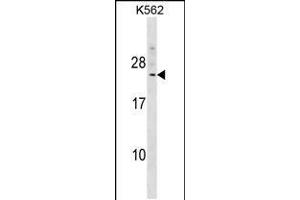 Western blot analysis in K562 cell line lysates (35ug/lane). (DCAKD antibody  (N-Term))