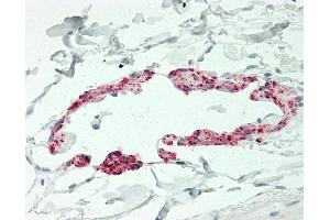 Human Small Intestine, Lymphatic Channel: Formalin-Fixed, Paraffin-Embedded (FFPE). (CCL21 antibody  (AA 24-134) (Biotin))