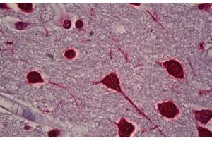 Anti-FOS / c-FOS antibody IHC staining of human brain, cortex. (c-FOS antibody)