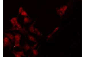 ABIN6267650 staining Hela by IF/ICC. (STAT4 antibody  (pTyr693))