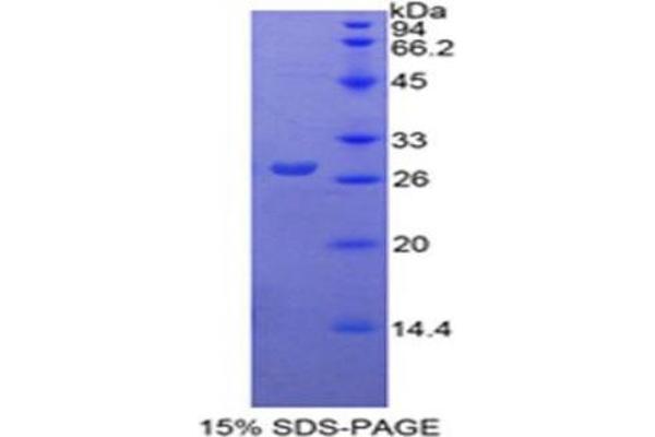 PKM Protein