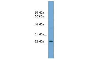 RAB39 antibody used at 1 ug/ml to detect target protein. (RAB39 antibody  (N-Term))