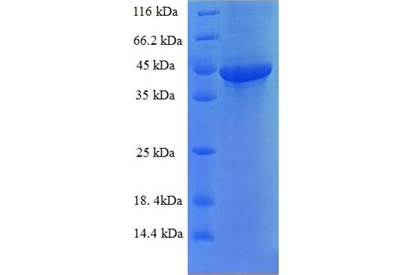 FAM109B Protein (AA 1-259, full length) (His-SUMO Tag)