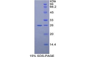 SDS-PAGE analysis of Human GRIP1 Protein. (GRIP1 Protein)