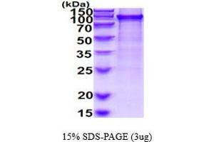 SDS-PAGE (SDS) image for SUMO1 Activating Enzyme Subunit 2 (UBA2) (AA 1-640) protein (His tag) (ABIN6387816) (UBA2 Protein (AA 1-640) (His tag))