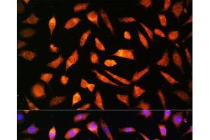 Immunofluorescence analysis of L929 cells using BNP Polyclonal Antibody at dilution of 1:100. (BNP antibody)