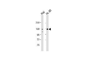 Western Blot at 1:2000 dilution Lane 1: Raji whole cell lysate Lane 2: HL-60 whole cell lysate Lysates/proteins at 20 ug per lane. (TERT antibody  (AA 1104-1132))