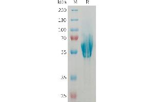 Human MAD Protein, His Tag on SDS-PAGE under reducing condition. (MADCAM1 Protein (AA 19-317) (His tag))