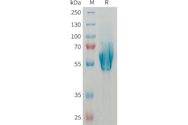 MADCAM1 Protein (AA 19-317) (His tag)