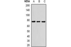 Western blot analysis of ATR expression in H460 (A), Hela (B), mouse spleen (C) whole cell lysates. (ATR antibody)
