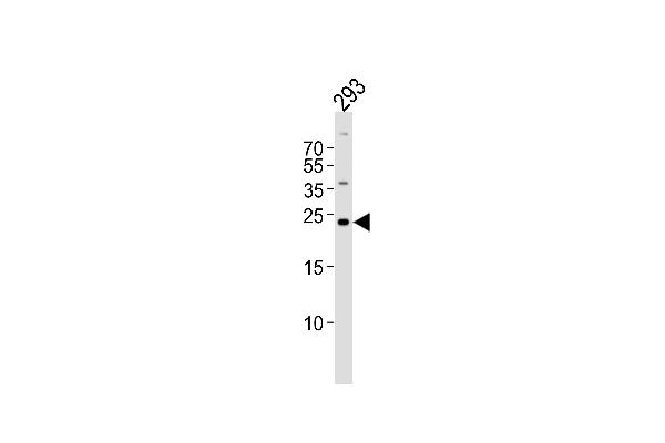 GADD45GIP1 Antikörper  (N-Term)