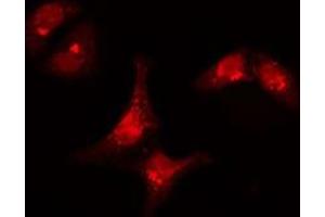 ABIN6277308 staining  Hela cells by IF/ICC. (KRT15 antibody  (N-Term))