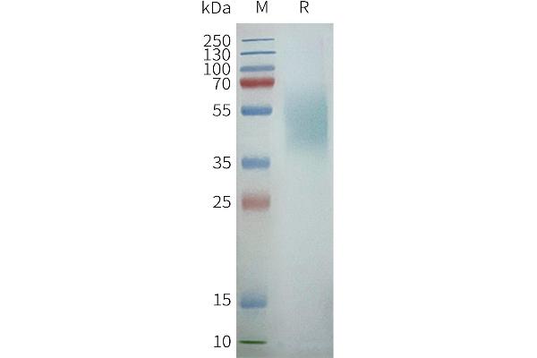 CXCR7 Protein