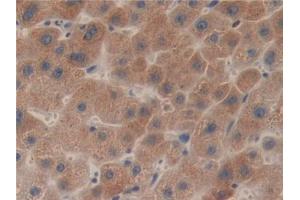 IHC-P analysis of Human Liver Tissue, with DAB staining. (LCAT antibody  (AA 41-210))