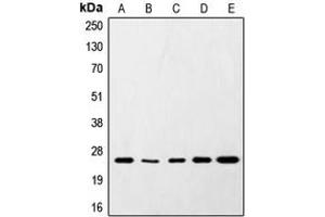 Western blot analysis of SNAP25 expression in HeLa (A), SKNSH (B), RAW264. (SNAP25 antibody  (C-Term))