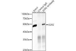 Immunoprecipitation analysis of 600 μg extracts of Mouse brain cells using 3 μg EGR2 antibody (ABIN1682321, ABIN7101509, ABIN7101510 and ABIN7101511). (EGR2 antibody)