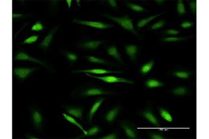 Immunofluorescence of monoclonal antibody to GTF2IRD1 on HeLa cell. (GTF2IRD1 antibody  (AA 1-959))