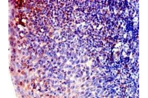 Immunohistochemistry of paraffin-embedded human tonsil tissue using ABIN7143081 at dilution of 1:100 (ARPC1B antibody  (AA 16-316))