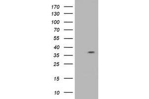 Western Blotting (WB) image for anti-Ras Association (RalGDS/AF-6) Domain Family Member 1 (RASSF1) antibody (ABIN1500609) (RASSF1 antibody)