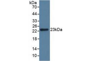 Figure. (GPX3 antibody  (AA 3-72))