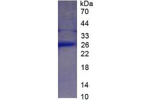 SDS-PAGE of Protein Standard from the Kit (Highly purified E. (CRP ELISA Kit)