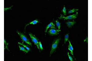 Immunofluorescent analysis of Hela cells using ABIN7159304 at dilution of 1:100 and Alexa Fluor 488-congugated AffiniPure Goat Anti-Rabbit IgG(H+L) (Melanophilin antibody  (AA 310-539))