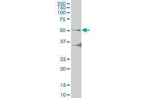 Western Blotting (WB) image for anti-Interleukin-1 Receptor-Associated Kinase 4 (IRAK4) (AA 1-130) antibody (ABIN599243) (IRAK4 antibody  (AA 1-130))