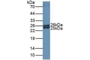 Western blot analysis of Mouse Lung Tissue. (Ferritin Mitochondrial antibody  (AA 54-229))