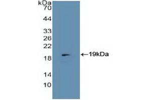 Western blot analysis of recombinant Human MCP. (CD46 antibody  (AA 147-285))