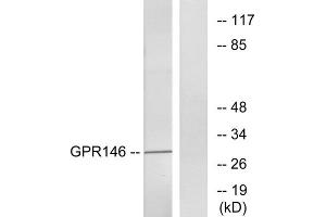 Western blot analysis of extracts from LOVO cells, using GPR146 antibody. (GPR146 antibody  (Internal Region))