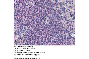 Immunohistochemistry (IHC) image for anti-Promyelocytic Leukemia (PML) (C-Term) antibody (ABIN404847) (PML antibody  (C-Term))