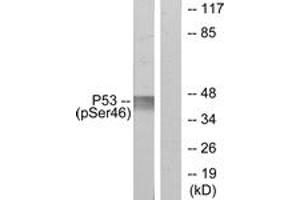 Western blot analysis of extracts from 293 cells treated with UV, using p53 (Phospho-Ser46) Antibody. (p53 antibody  (pSer46))