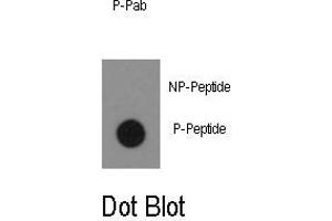 Image no. 1 for anti-C-Abl Oncogene 1, Non-Receptor tyrosine Kinase (ABL1) (pTyr134) antibody (ABIN358067) (ABL1 antibody  (pTyr134))