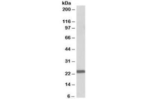 Western blot testing of human bone marrow lysate with IL15 antibody at 1ug/ml. (IL-15 antibody)